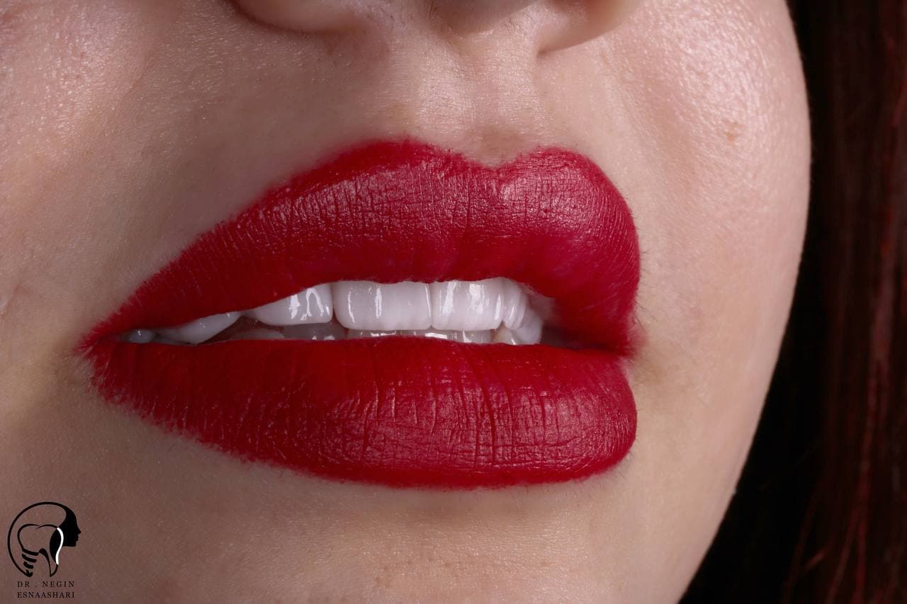 negin clinic shiraz ( کلینیک دهان پزشکی و دندانپزشکی نگین شیراز ) 5