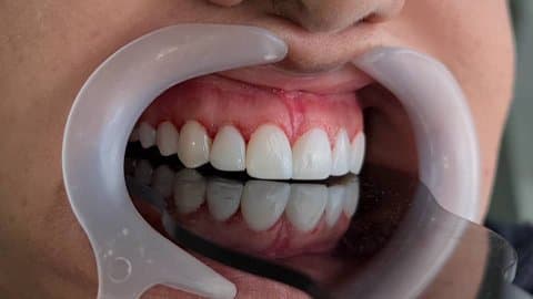کلینیک تخصصی ایمپلنت و لمینت دندان مریم 4