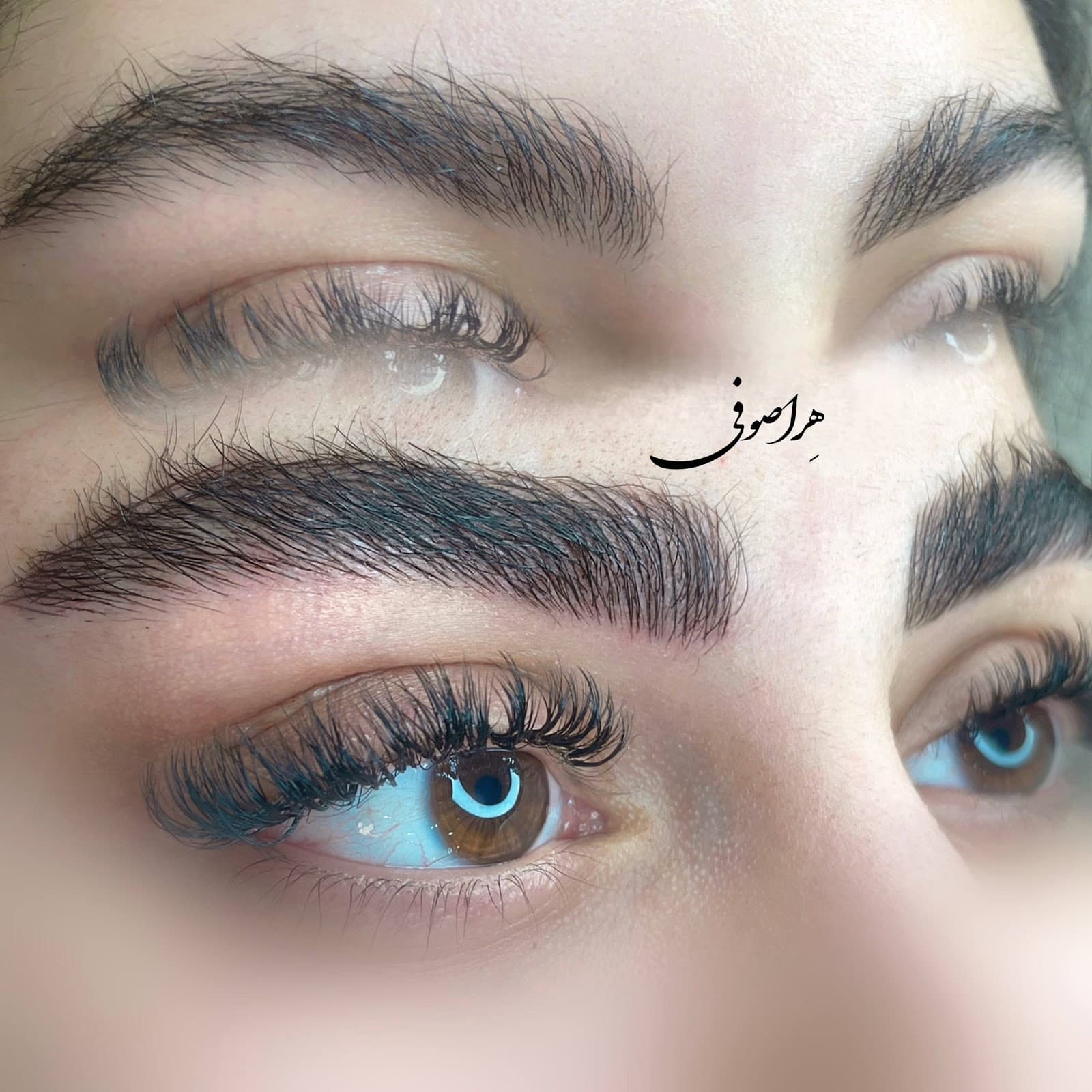 مرکز تخصصی فیبروز | میکروپیگمنتیشن هرا صوفی 2