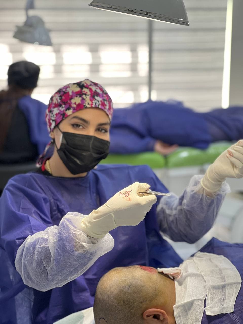 مطب کاشت مو مه لقا قربانی 2