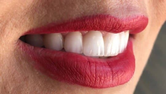 کلینیک تخصصی ایمپلنت و لمینت دندان مریم 5