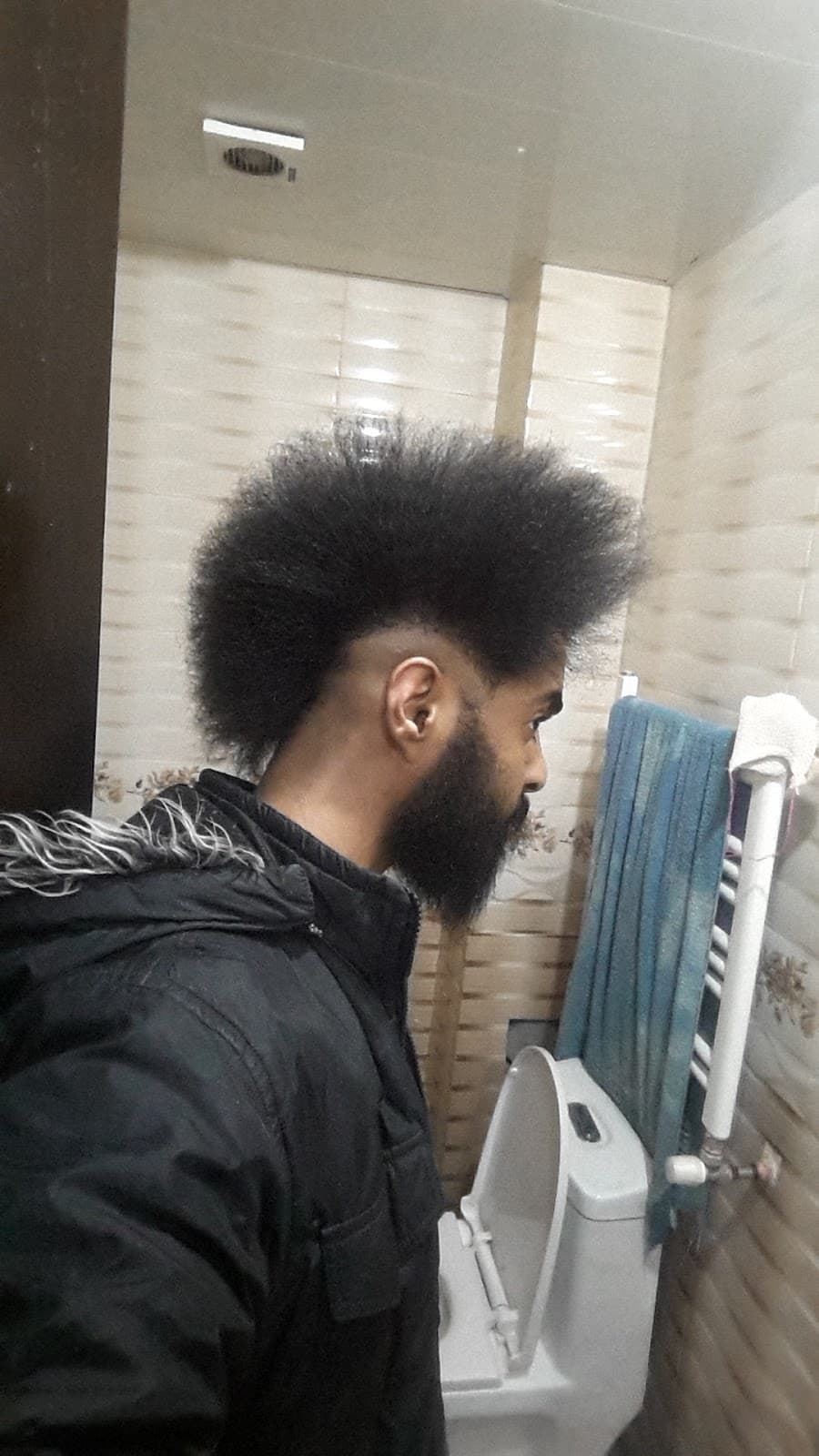 Ariyan hair transplant clinic 4