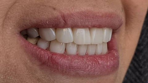 کلینیک تخصصی ایمپلنت و لمینت دندان مریم 2